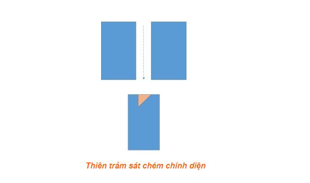 Thiên trảm sát chính diện